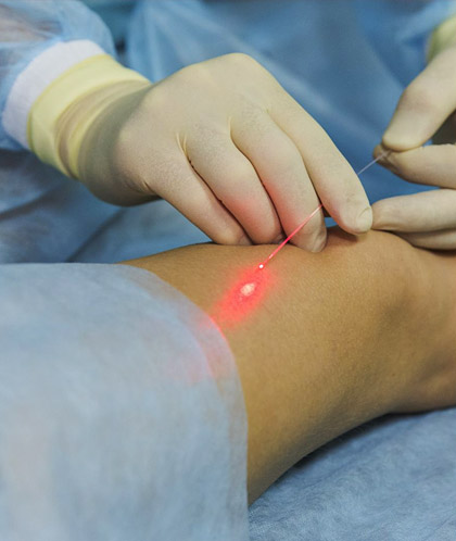 Ультрафиолетовое облучение крови УФО на Камчакте в мед центре Медитекс