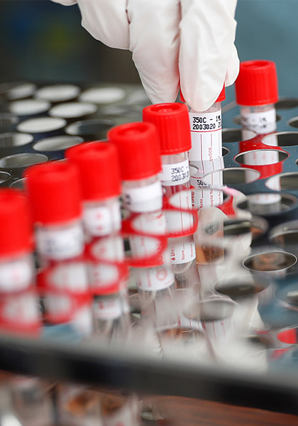 Медицинский центр Медитекс осуществляет забор крови на антитела IgG к вирусу SARS-CoV-2